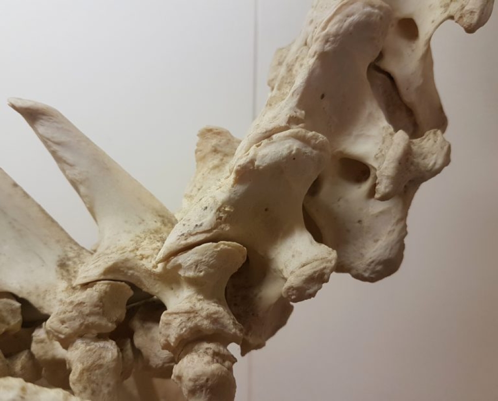 De overgang van halswervels naar borstwervels.