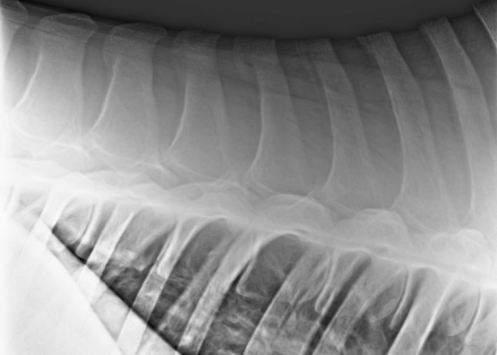 Röntgenopname van de rug