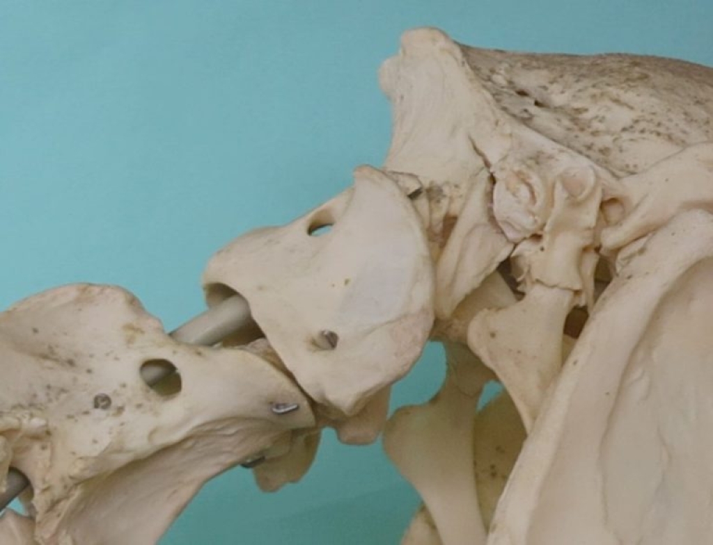 Anatomie van het achterhoofd en de eerste halswervels