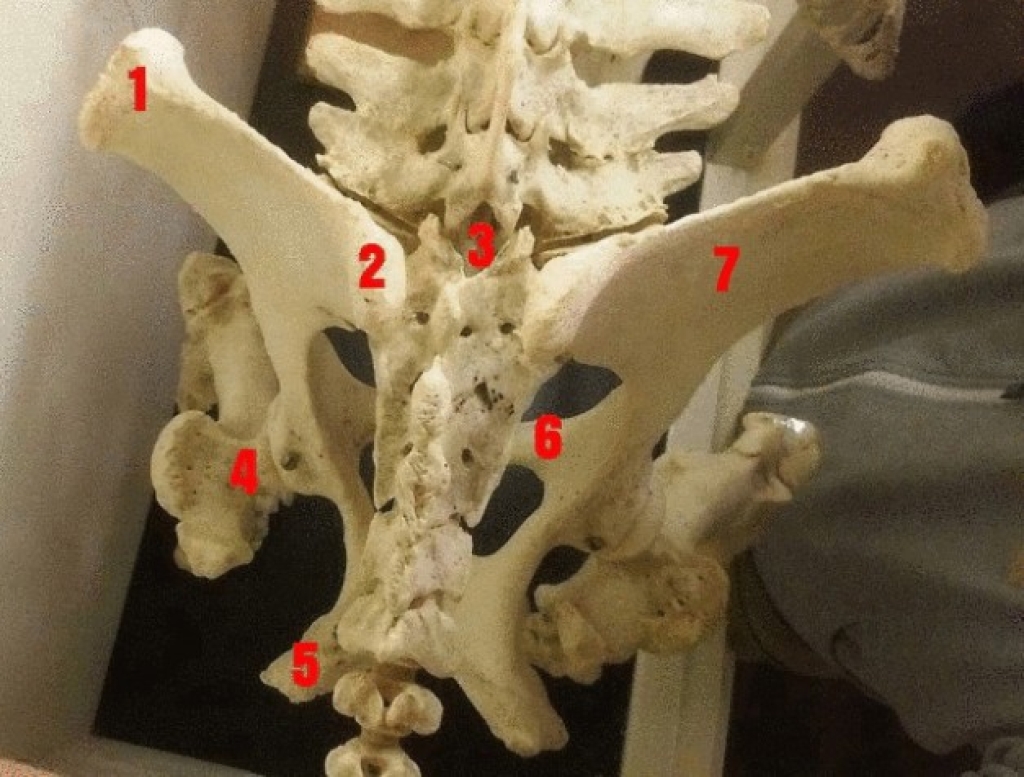 Figuur 1: Bekkenaanzicht van boven