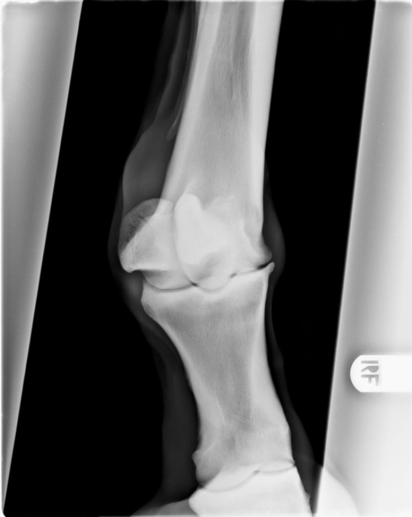 Röntgenopname van een gewricht met artrose