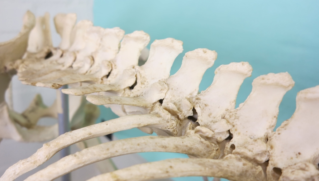 De facetgewrichten van de borst- en lendenwervels