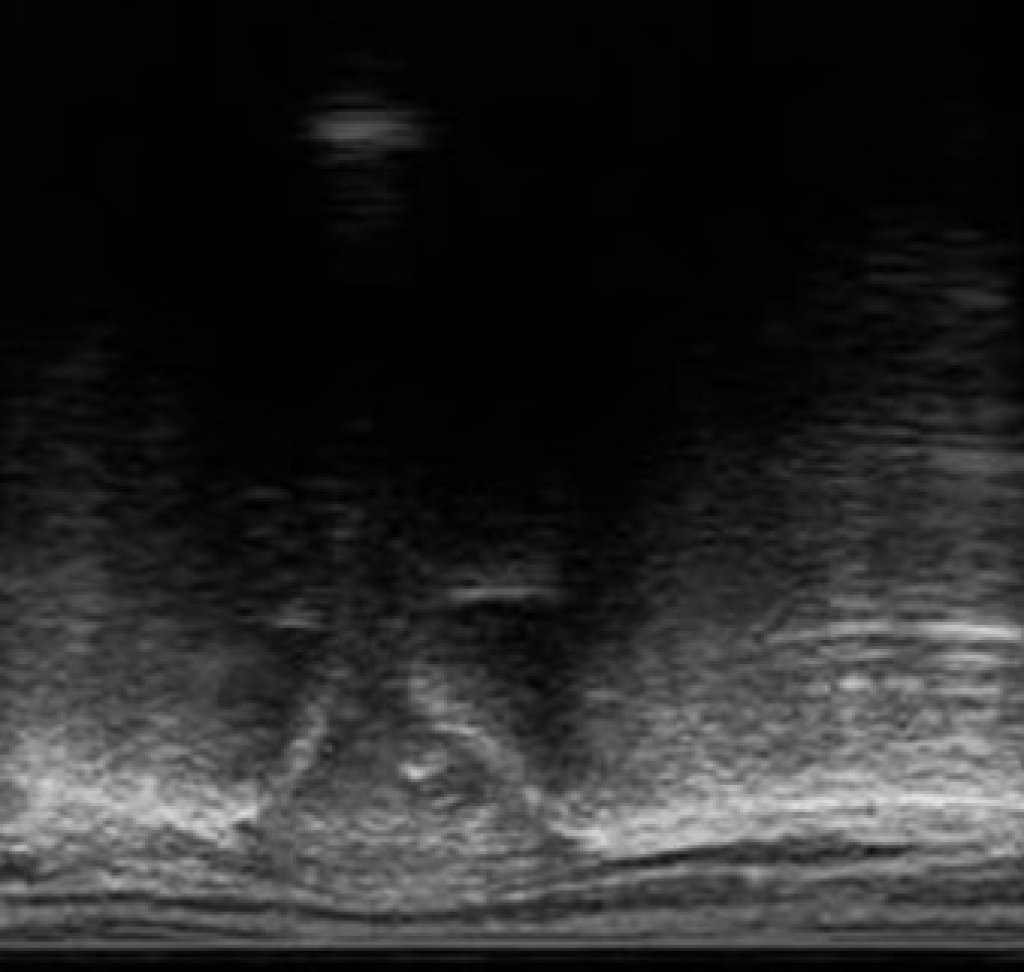 Transrectaal onderzoek naar het bekken (SI gewrichten en lumbosacraal) is een onderdeel van de sportkeuring