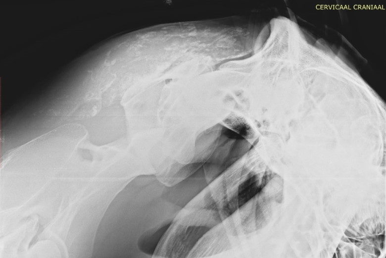 Halsproblemen bij het paard: slijmbeursontsteking in de hals